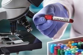 راه‌اندازی آزمایشگاه تشخیص کرونا در پژوهشگاه رویان