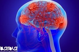 اختلالات مغزی، علامت دیگر کرونا