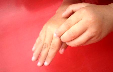 تشخیص کرونا را از روی پوست بیمار