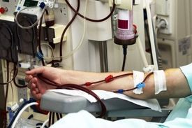 افزایش آمار مرگ و میر ناشی از بیماری مزمن کلیه در جهان