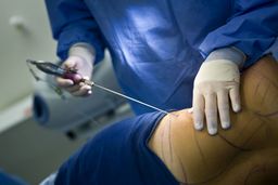 فوت یک زن بخاطر جراحی لاغری! / همسر پریسا: شکایت کرده‌ایم و تا آخرش پیگیر این ماجرا هستیم
