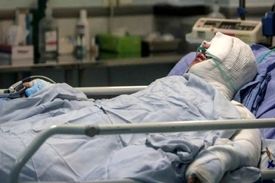 پلیس در تعقیب عامل اسیدپاشی در شهرک ژاندارمری