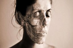 عجیب‌ترین و نادرترین بیماری‌های دنیا / از سندروم انفجار سر تا آلیس در سرزمین عجایب