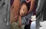 سازمان ملل: هر ۱۲ دقیقه، یک کودک زیر ۵ سال در یمن جان می‌بازد
